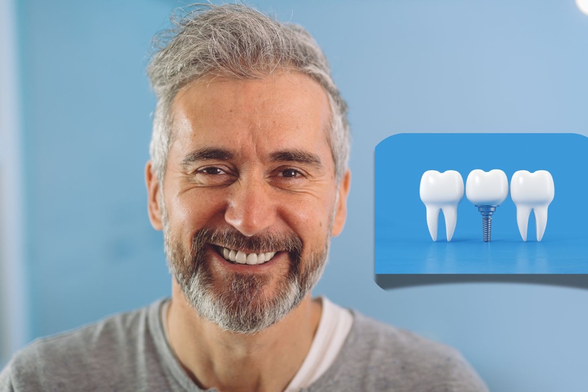Dental Implants Banner
