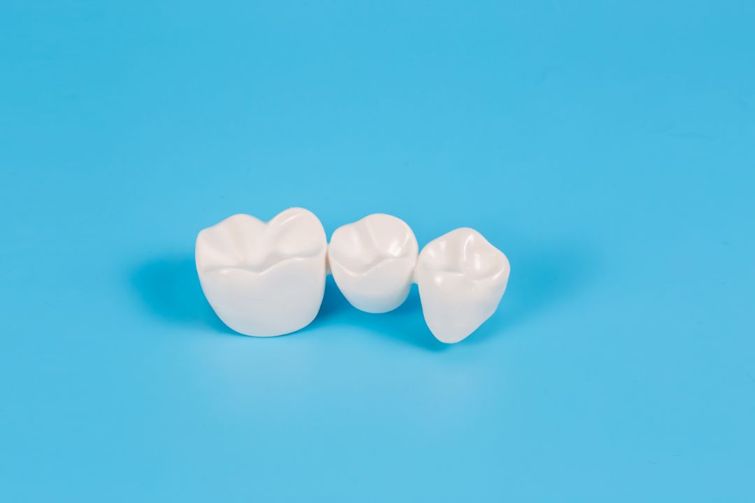 Dental Crowns