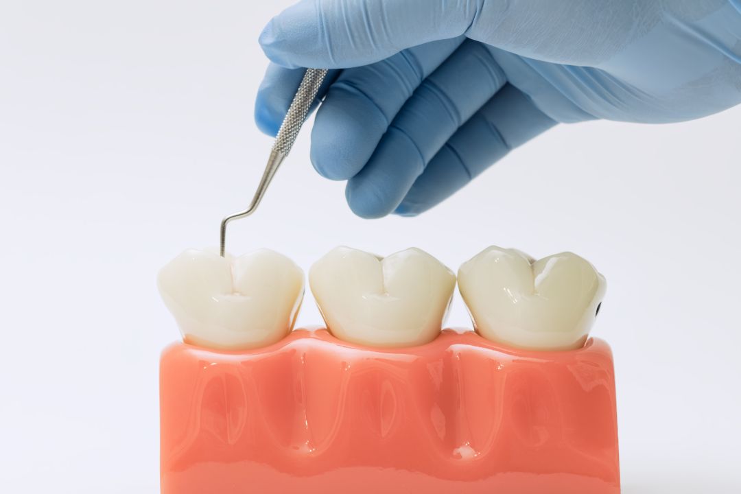 Routine Dental Cleanings