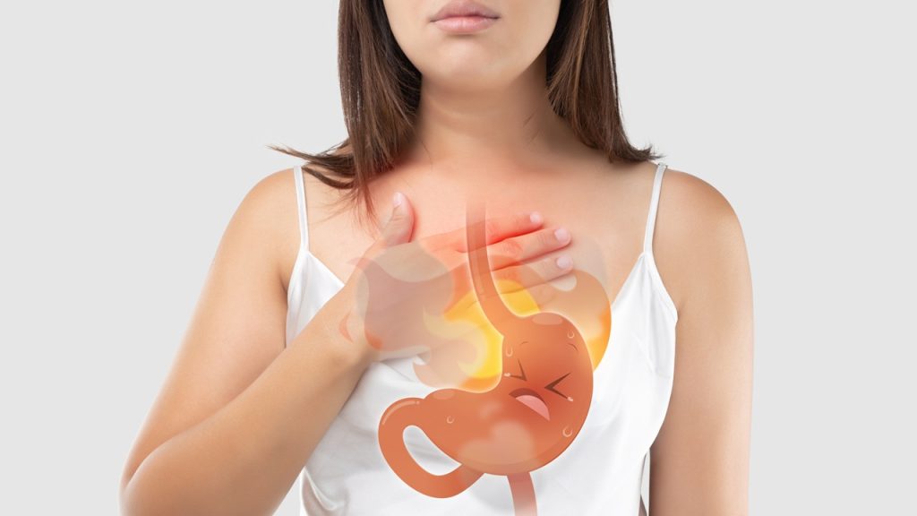 Acid-Reflux-Heartburn-Symptom
