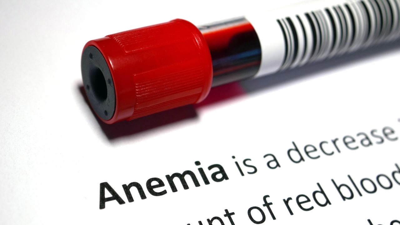 Anemia Types, Symptoms, and Treatment
