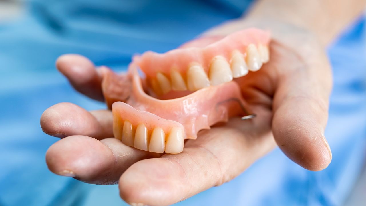 Dental Implants vs Dentures