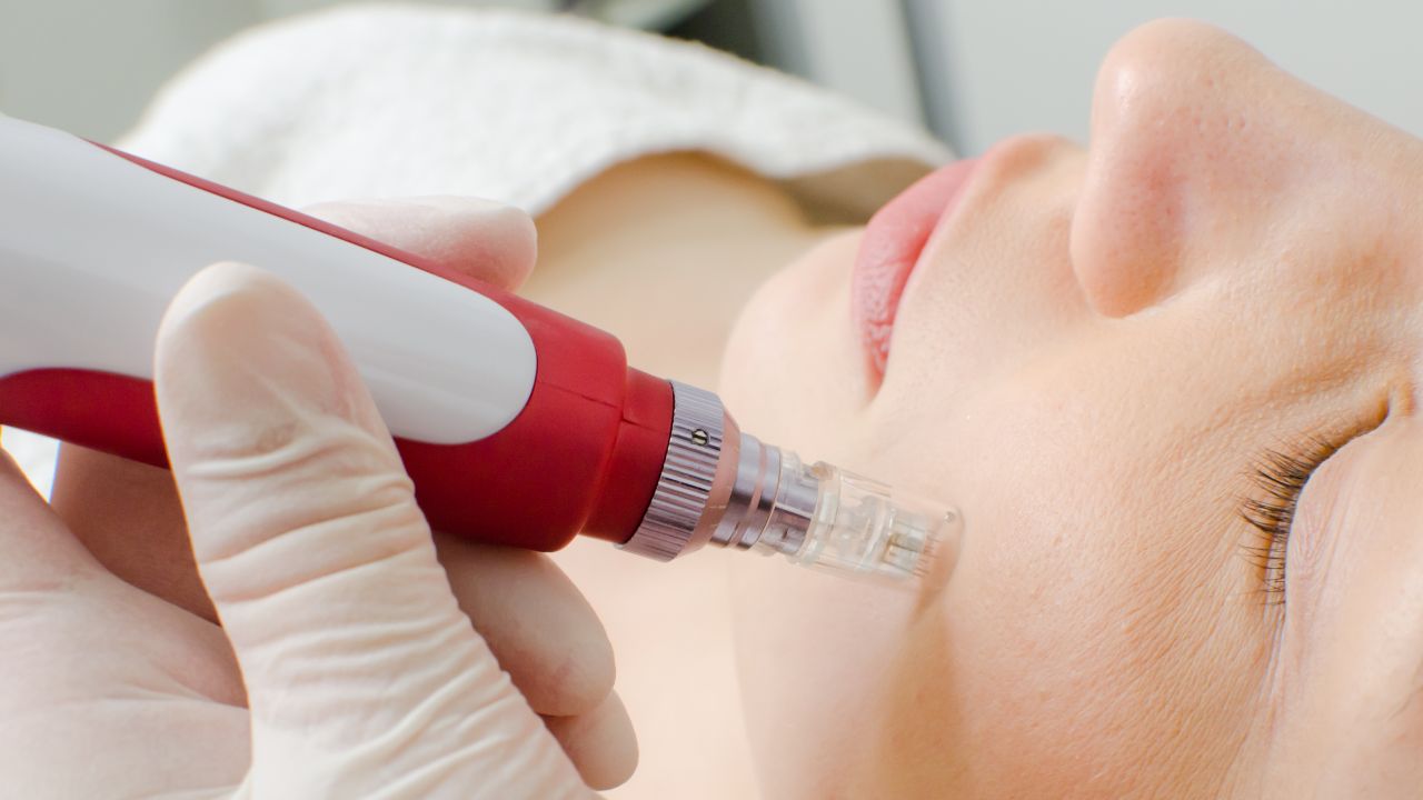 Dermapen Microneedling in Dubai